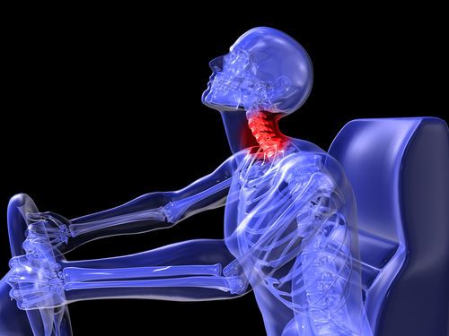 The most common head and neck injury caused by car accidents