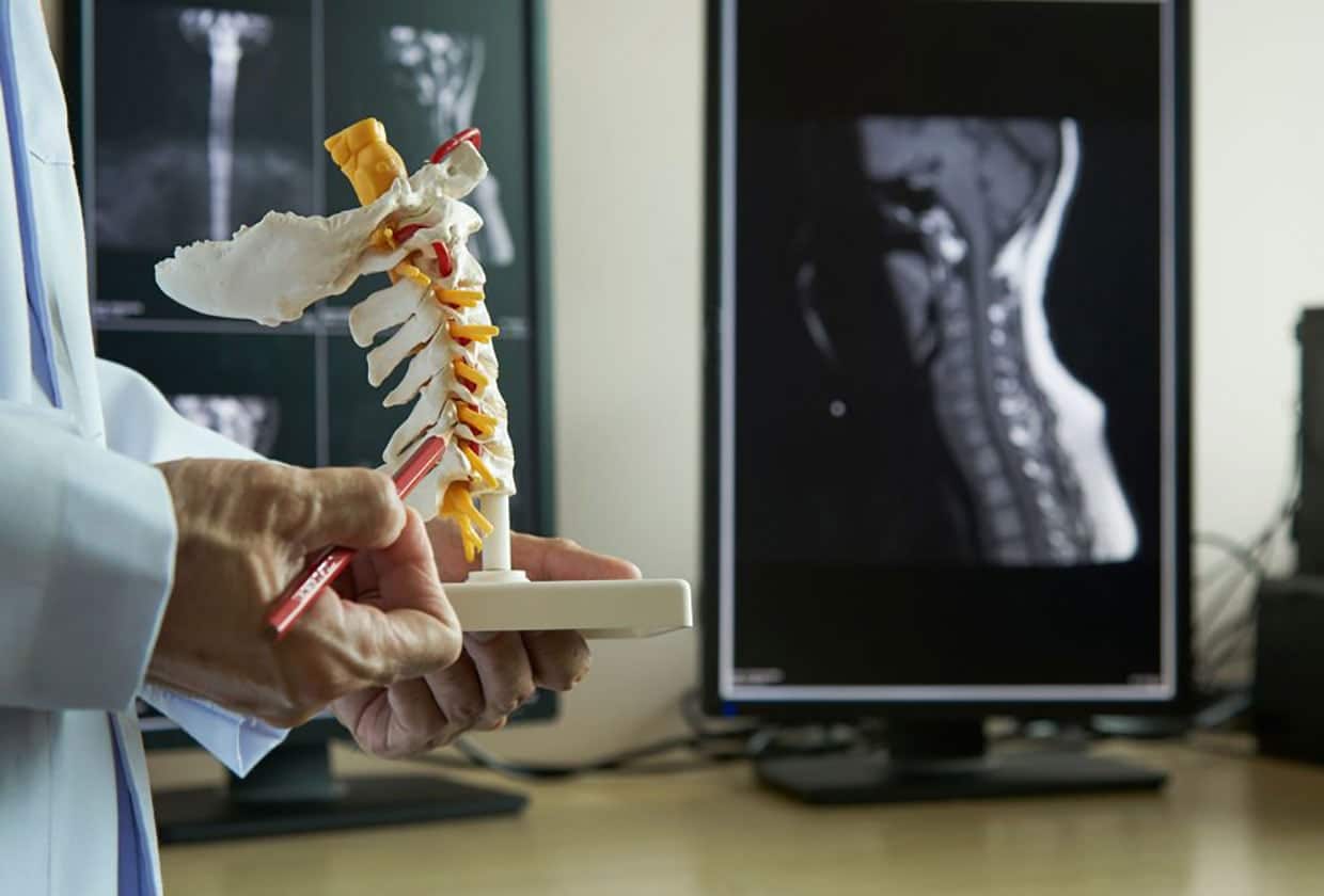 Spinal cord injuries